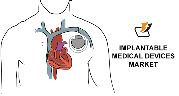 File:Implantable-medical1.png